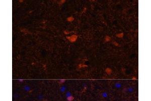Immunofluorescence analysis of Rat brain using S100B Polyclonal Antibody at dilution of 1:100. (S100B Antikörper)