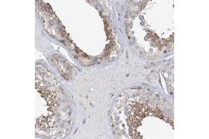 Immunohistochemical staining (Formalin-fixed paraffin-embedded sections) of human testis with MAP4K5 polyclonal antibody  shows moderate positivity in a subset of cells in seminiferus ducts. (MAP4K5 Antikörper)
