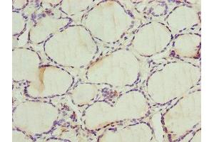 Immunohistochemistry of paraffin-embedded human thyroid tissue using ABIN7142596 at dilution of 1:100 (ALAS2 Antikörper  (AA 50-587))