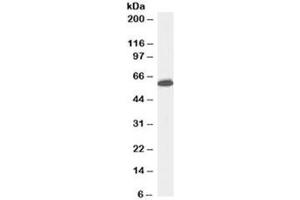 Western blot testing of Jurkat lysate with Nup50 antibody at 0. (NUP50 Antikörper)