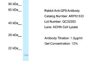 Western Blotting (WB) image for anti-Glycoprotein IX (Platelet) (GP9) (Middle Region) antibody (ABIN786439) (CD42a Antikörper  (Middle Region))