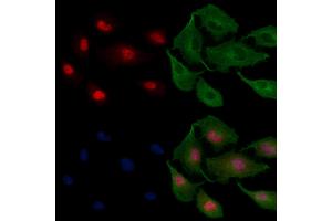 ABIN6258128 and ABIN6275417 staining  cells by IF/ICC. (DYRK3 Antikörper)