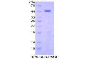 SDS-PAGE (SDS) image for Pro-Platelet Basic Protein (Chemokine (C-X-C Motif) Ligand 7) (PPBP) (AA 1-119) protein (His tag,GST tag) (ABIN2122489)