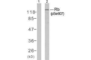 Western blot analysis of extracts from K562 cells untreated or treated with 10% serum after 48 hours of starvation, using Rb (phospho-Ser807) antibody (E011131). (Retinoblastoma 1 Antikörper  (pSer807))