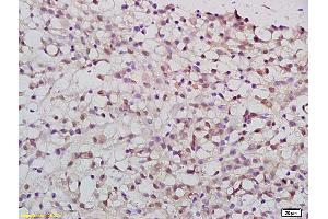 Formalin-fixed and paraffin embedded rat brain tissue labeled with Anti-PATZ1 Polyclonal Antibody, Unconjugated (ABIN759836) at 1:200 followed by conjugation to the secondary antibody and DAB staining (PATZ1 Antikörper  (AA 351-450))