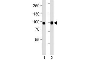Western blot analysis of lysate from (1) A549 and (2) HeLa cell line using FGFR3 antibody at 1:1000. (FGFR3 Antikörper  (AA 449-482))