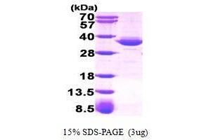 Figure annotation denotes ug of protein loaded and % gel used. (GPD1 Protein (AA 1-349))