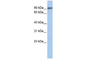GTSE1 antibody used at 1 ug/ml to detect target protein.