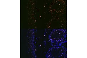 Immunofluorescence (IF) image for anti-Microphthalmia-Associated Transcription Factor (MITF) antibody (ABIN7268511)