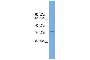 Western Blotting (WB) image for anti-Methylmalonic Aciduria (Cobalamin Deficiency) CblD Type, with Homocystinuria (MMADHC) (N-Term) antibody (ABIN2786152)