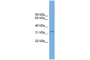 WB Suggested Anti-C2orf25 Antibody Titration: 0. (MMADHC Antikörper  (N-Term))
