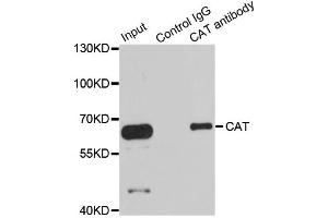Immunoprecipitation analysis of 100ug extracts of HepG2 cells using 3ug CAT antibody. (Catalase Antikörper)