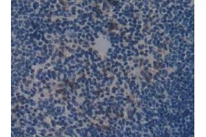 Detection of COL1a2 in Mouse Spleen Tissue using Polyclonal Antibody to Collagen Type I Alpha 2 (COL1a2) (COL1A2 Antikörper  (AA 1109-1372))