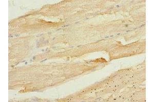 Immunohistochemistry of paraffin-embedded human skeletal muscle tissue using ABIN7146597 at dilution of 1:100 (CALU Antikörper  (AA 20-315))