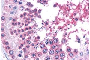 Human Testis: Formalin-Fixed, Paraffin-Embedded (FFPE) (SMARCA4 Antikörper  (C-Term))