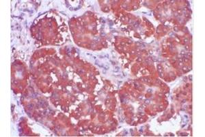 Immunohistochemistry (IHC) image for anti-Trefoil Factor 1 (TFF1) (AA 57-84), (C-Term) antibody (ABIN781662) (TFF1 Antikörper  (C-Term))