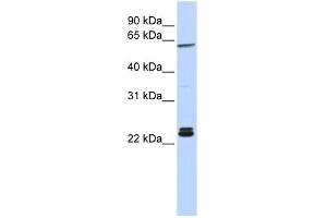 H1F0 antibody used at 1 ug/ml to detect target protein.