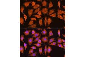 Immunofluorescence analysis of L929 cells using NCSTN Rabbit pAb (ABIN7268905) at dilution of 1:100. (Nicastrin Antikörper  (AA 429-669))