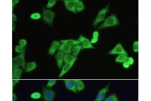 Immunofluorescence analysis of HeLa cells using SLC2A9 Polyclonal Antibody at dilution of 1:100. (SLC2A9 Antikörper)