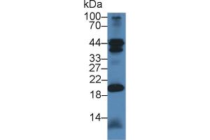 Western Blot; Sample: Mouse Cerebellum lysate; Primary Ab: 1µg/ml Rabbit Anti-Mouse CHN2 Antibody Second Ab: 0.