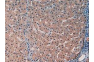 IHC-P analysis of Human Liver Tissue, with DAB staining. (GAA Antikörper  (AA 595-770))