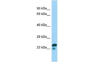 WB Suggested Anti-SPIN2A Antibody Titration: 1. (SPIN2A Antikörper  (N-Term))