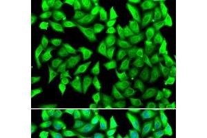 Immunofluorescence analysis of U2OS cells using VTI1B Polyclonal Antibody (VTI1B Antikörper)