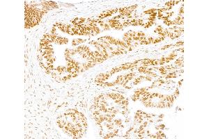 Immunohistochemistry (IHC) image for anti-SWI/SNF Related, Matrix Associated, Actin Dependent Regulator of Chromatin, Subfamily A, Member 2 (SMARCA2) (AA 100-150) antibody (ABIN7795710)
