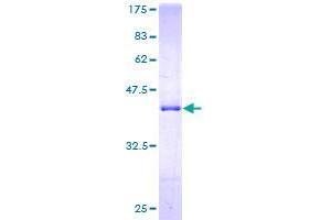 Image no. 1 for Thioredoxin-Like 4A (TXNL4A) (AA 1-142) protein (GST tag) (ABIN1324244) (TXNL4A Protein (AA 1-142) (GST tag))