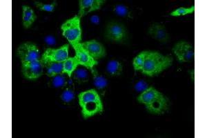 Immunofluorescence (IF) image for anti-Insulin-Like Growth Factor 2 mRNA Binding Protein 2 (IGF2BP2) antibody (ABIN1498823)