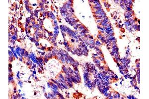 Immunohistochemistry (IHC) image for anti-FK506 Binding Protein 6, 36kDa (FKBP6) (AA 101-327) antibody (ABIN7156155)