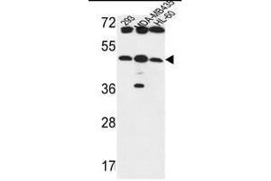 B3GNT5 Antibody (Center) western blot analysis in 293,MDA-MB435,HL-60 cell line lysates (35µg/lane).