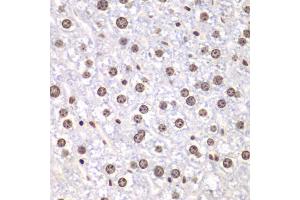Immunohistochemistry of paraffin-embedded mouse liver using TOP1 antibody (ABIN6290286) at dilution of 1:100 (40x lens).