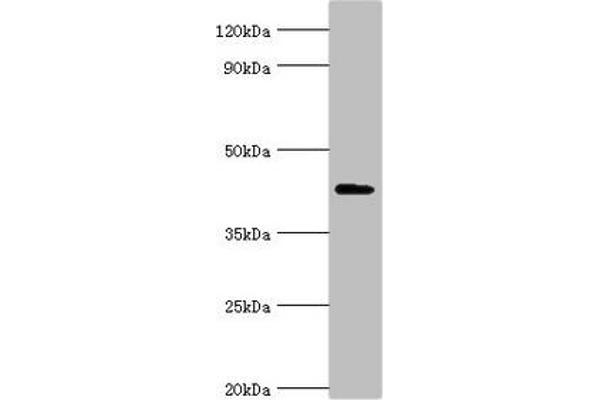 AIPL1 Antikörper  (AA 1-384)