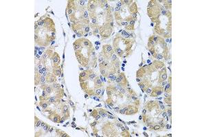 Immunohistochemistry of paraffin-embedded human gastric using BAG5 antibody at dilution of 1:100 (x40 lens). (BAG5 Antikörper)