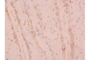 IHC-P analysis of Human Kidney Tissue, with DAB staining. (ALOX15 Antikörper  (AA 170-312))