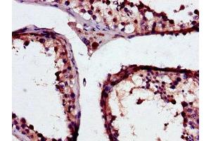 Immunohistochemistry of paraffin-embedded human testis tissue using ABIN7154107 at dilution of 1:100