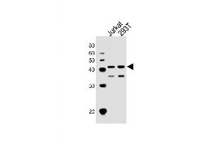 Western Blot at 1:1000 dilution Lane 1: Jurkat whole cell lysates Lane 2: 293T whole cell lysates Lysates/proteins at 20 ug per lane. (ETS1 Antikörper  (N-Term))