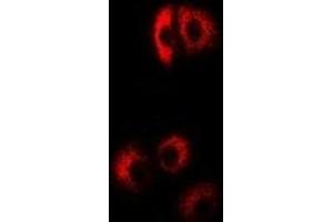 Immunofluorescent analysis of EIF4B staining in Hela cells. (EIF4B Antikörper)