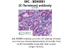 Image no. 1 for anti-Bradykinin Receptor B1 (BDKRB1) (C-Term) antibody (ABIN2852366)