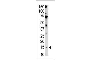 Image no. 1 for anti-BCL2-Interacting Killer (Apoptosis-Inducing) (BIK) (N-Term) antibody (ABIN356832) (BIK Antikörper  (N-Term))