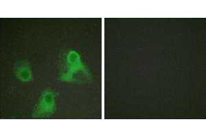 P-peptide - +Immunofluorescence analysis of HeLa cells, using ADD1 (phospho-Ser726) antibody (#A0002). (alpha Adducin Antikörper  (pSer726))