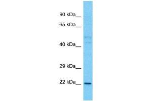 Western Blotting (WB) image for anti-TLC Domain Containing 1 (TLCD1) (C-Term) antibody (ABIN2791939) (TLCD1 Antikörper  (C-Term))