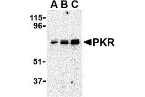 Western Blotting (WB) image for anti-Eukaryotic Translation Initiation Factor 2-alpha Kinase 2 (EIF2AK2) (C-Term) antibody (ABIN1030589) (EIF2AK2 Antikörper  (C-Term))