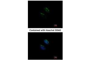 ICC/IF Image Immunofluorescence analysis of methanol-fixed HeLa, using GnT-III, antibody at 1:200 dilution. (MGAT3 Antikörper)