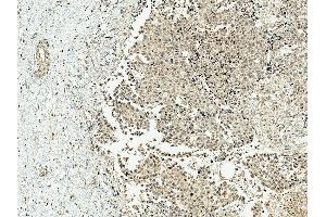 Immunohistochemistry analysis using Rabbit Anti-CBP Polyclonal Antibody (ABIN5667459). (CBP Antikörper  (AA 2100-2200) (FITC))