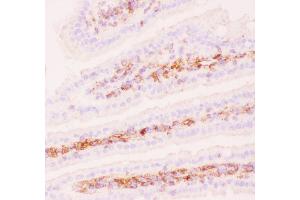 Immunohistochemistry (IHC) image for anti-ATP-Binding Cassette, Sub-Family B (MDR/TAP), Member 1 (ABCB1) (AA 621-650), (Middle Region) antibody (ABIN3043967)
