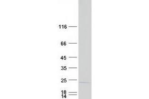 Western Blotting (WB) image for Neuron-Specific Protein Family Member 2 (HMP19) protein (Myc-DYKDDDDK Tag) (ABIN2727643)
