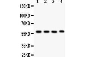 Western Blotting (WB) image for anti-Cytochrome P450, Family 1, Subfamily A, Polypeptide 1 (CYP1A1) (AA 183-320) antibody (ABIN3043819) (CYP1A1 Antikörper  (AA 183-320))