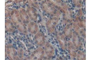 Detection of HSD17b12 in Mouse Kidney Tissue using Polyclonal Antibody to 17-Beta-Hydroxysteroid Dehydrogenase Type 12 (HSD17b12)